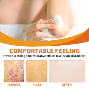 Offres Spéciales crème de soin au venin d'abeille Ximonth soulagement du psoriasis eczéma réparateur <span class=keywords><strong>Anti</strong></span> démangeaisons crème <span class=keywords><strong>anti</strong></span>-psoriasis nourrissante - Product Image 4