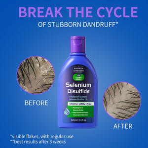 Shampoo antipelliculaire au disulfure de sélénium, soin des cheveux, soyeux, lisse, hydratant, nettoyant, unisexe, adultes - Product Image 4