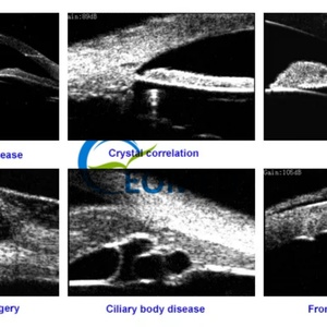 Équipement ophtalmique chinois, biomicroscope à ultrasons portable UBM, UBM3200S - Product Image 6