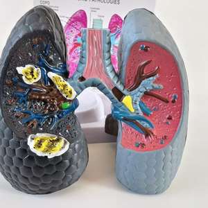 Modelo Anatómico Patológico de Corazón y Pulmón Humano con Imágenes - Medicina - Modelo del Sistema Respiratorio Pulmonar - Product Image 3