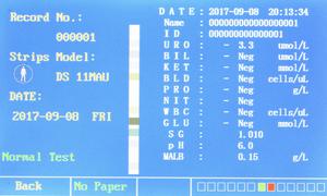 Instruments d'analyse urinoir Semi-automatique, de clinique, approuvé avec une machine de analyseur urinoir <span class=keywords><strong>CE</strong></span> - Product Image 5