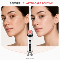 Nouveau masseur facial rechargeable par USB, anti-rides, vibration multi-fréquence, lumière colorée, chaud et froid, rouleau raffermissant pour la peau du visage