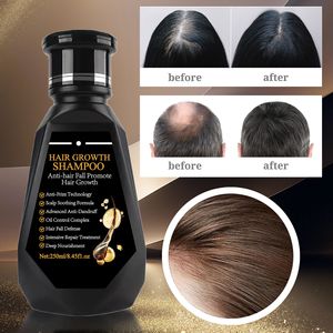 Shampooing Chinois <span class=keywords><strong>Anti</strong></span>-<span class=keywords><strong>Chute</strong></span> en Gros au Gingembre et Biotine pour Nettoyage en Profondeur des Cheveux, Renforcement des Racines, Croissance Capillaire Bio pour Hommes et Femmes - Product Image 6