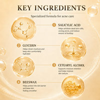 Crème pour le visage contre l'acné, élimine les marques d'acné, resserre les pores, adoucit et lisse la peau, améliore la peau acnéique, crème de soin du visage, crème de soin de la peau