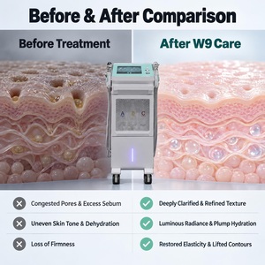 W9 Sauerstoff-Blasen Gesichts-Schönheitsgerät 9-in-1 Hydro-Dermabrasion Sauerstoff-Jet-Peel-Gerät für Salon-Hautpflege - Product Image 2