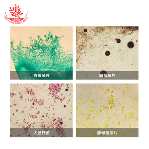 สไลด์จุลินทรีย์แบคทีเรียและเชื้อรา 10 ชนิด มาตรฐานสำหรับการศึกษาระดับอุดมศึกษา เพื่อการสอนและการวิจัยด้านรูปทรงของแบคทีเรีย - Product Image 5