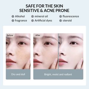 Biosphere Private <b>Label</b> OEM/ODM Moisturizing Skin Care Skincare Natural Organic Whitening Freckle <b>Removing</b> Toner for Face - Product Image 5