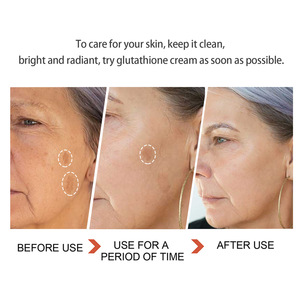 Aixin Beauté Marque privée 50G Crème hydratante pour l'élimination des cicatrices, des rides et des taches brunes Crème pour le <span class=keywords><strong>visage</strong></span> au glutathion - Product Image 6