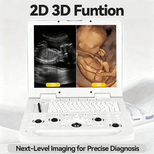 Equipo Dental Karestar K-H109A, Sistema de Ultrasonido Veterinario Portátil 3D, Múltiples Sondas, Ecológico, con Certificación CE - Product Image 2