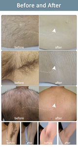 Ice Freeze Mini Portable 755 808 1064nm Máquina de depilación corporal con láser de diodo para el rejuvenecimiento de la piel - Product Image 6