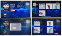 IPTV stb hotel Android IP stb para el hospital de la comunidad de iptv