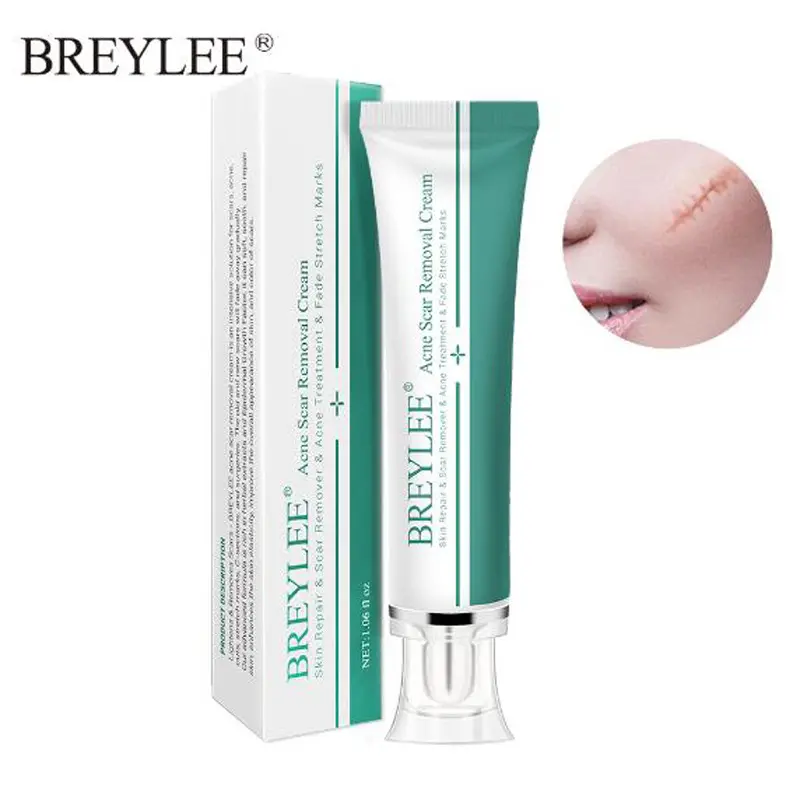 Großhandel Breylee Akne Narben entfernungs creme Behandlungs creme 30g Gesichts narben entfernungs creme