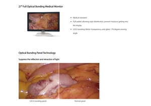 Mingray Vetina CS3 sistem <span class=keywords><strong>Ultrasound</strong></span> Digital, sistem 3D 4D CW opsional portabel Doppler warna dokter hewan Usg - Product Image 2