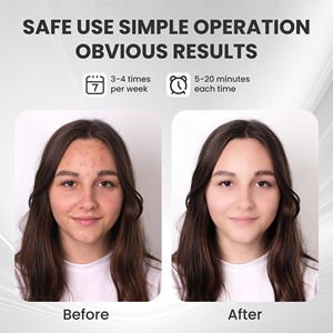 Illuminazione Sanitaria 2025 Nuova Maschera Facciale LED 7 Colori 850Nm Ricaricabile in Silicone Dispositivo Anti-Rughe e Anti-Acne - Product Image 4