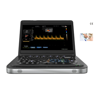 Ecógrafo Doppler Color Humano de Pantalla de 15.6 Pulgadas con Vista Vascular Clara y Respuesta Rápida SUN-902B - Product Image 1