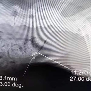 SY-WPS01 Veterinary Holmium <strong>Laser</strong> Lithotripter <strong>Surgical</strong> Use Minimally Invasive Lithotripsy Stone Fragmentation Machines - Product Image 4