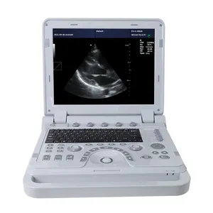 CONTEC-máquina de ultrasonido portátil de fábrica, sistema de ultrasonido, Doppler de color, dispositivo de diagnóstico ultrasónico