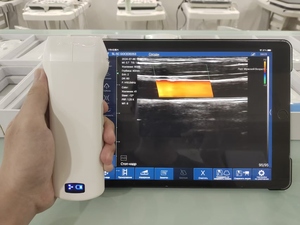 Sonde d'échographie linéaire sans fil portable 192 éléments DMU88 7,5-10 MHz pour examen clinique MSK (système musculo-squelettique) - Product Image 6