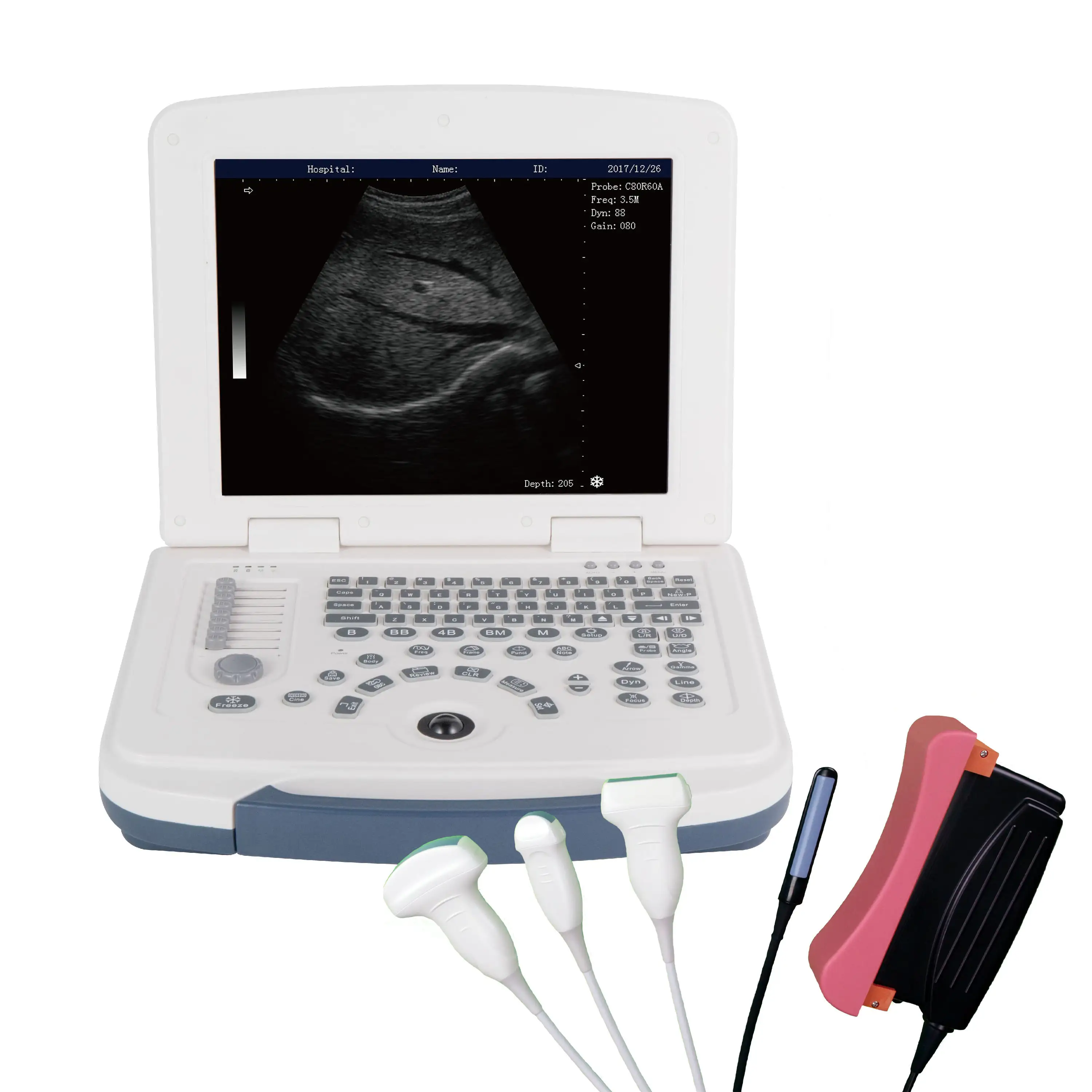 Pemindai Ultrasound portabel, pemindai Ultrasound Usb Bovine vaskuler Doppler sapi Usb sistem Ultrasound Bw untuk kehamilan