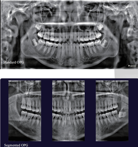 Système de radiographie dentaire numérique 3D CBCT intelligent avec interface conviviale, positionnement automatique du patient, technologie de <span class=keywords><strong>numérisation</strong></span> rapide - Product Image 5