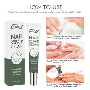 Trattamento per Unghie Fungine OEM, Facile da Usare, Leggero, Delicato sulla Pelle, Crema Riparatrice per Unghie per Rimuovere i Funghi dai Piedi - Product Image 3