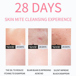 <span class=keywords><strong>โฟม</strong></span><span class=keywords><strong>ล้าง</strong></span><span class=keywords><strong>หน้า</strong></span>ออร์แกนิคโอวิลซ์ โรส เฟซวอช ผสมวิตามินซี สำหรับผิวมัน เป็น<span class=keywords><strong>สิว</strong></span>ง่าย ช่วยทำความสะอาดผิว<span class=keywords><strong>หน้า</strong></span> - Product Image 6