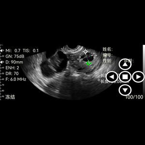 휴대용 초음파 스캐너 기계 전력 소스 플라스틱 초음파 요법 및 젤 워머 - Product Image 5