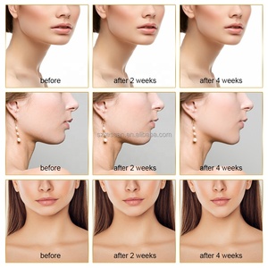 Appareil électrique pour le double menton V-Face, intensités réglables, machine intelligente V-Face pour le contouring du double menton - Product Image 6