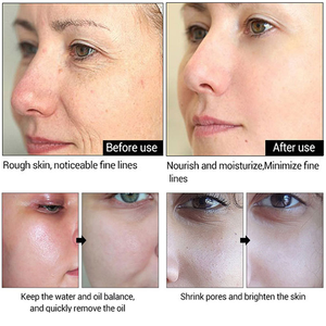 Siero per il viso di collagene organico OEM con vitamina C retinolo poro che restringe il siero idratante siero trattamento Anti età - Product Image 4