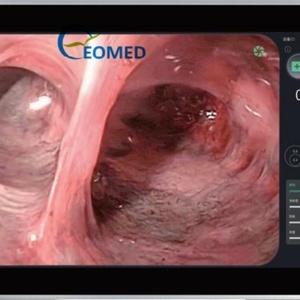 Endoscope vétérinaire flexible pour cholangiographie humaine 210 °   Déflexion et 120 °   Endoscope médical chirurgical série CH pour champ de vision étendu - Product Image 2