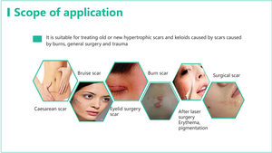 Juyou Chất Lượng Cao 100% An Toàn Dễ Sử Dụng Gel Silicon Loại Bỏ Sẹo Cho Các Loại Sẹo - Product Image 6