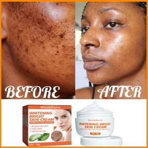 Crema facial efectiva <span class=keywords><strong>para</strong></span> blanquear manchas oscuras, pigmento alivia pecas, Corrector de <span class=keywords><strong>Melasma</strong></span>, belleza de la piel, OEM - Product Image 2