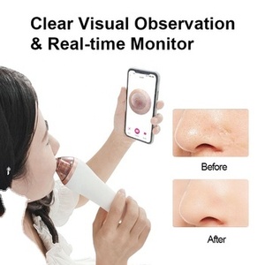 Extracteur de points noirs, nettoyeur de pores du nez, aspirateur à points noirs, appareil de suppression des points noirs avec caméra - Product Image 2
