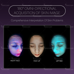 Perfectlaser Mới Nhất 9 Phổ Phân Tích Da Máy Mặt Chuyên Nghiệp Android Ai Thuật Toán Phân Tích Da Máy - Product Image 4