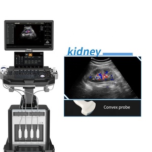 Ecógrafo Veterinario Dawei DW-T30 con Tecnología de Submatriz y Carro, Precio Económico en China, para Animales Pequeños - Product Image 5