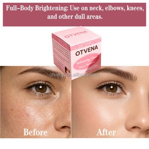 Crema Aclarante para la Piel, Blanqueadora, Iluminadora, Reduce Manchas Oscuras, Melasma, Pecas, Crema Facial Hidratante - Product Image 6