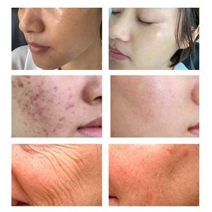 ครีมบำรุงผิวแบบจีนกรดไฮยาลูโรนิกให้ความชุ่มชื้นและซ่อมแซมผิวที่ถูกทำลาย - Product Image 6