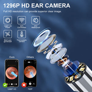 Nettoyeur d'oreille visuel avec caméra, kit de retrait de cérumen, otoscope, endoscope de retrait de cérumen, outil de nettoyage d'oreille, mini caméra, recharge USB-C - Product Image 5