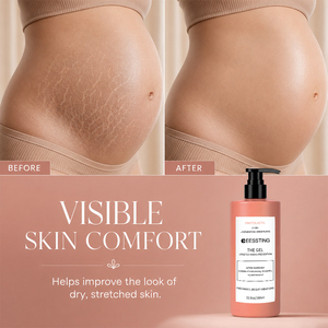 Crème/Gel Hydratant et Lissant Anti-Démangeaisons pour le Corps de Maternité OEM/ODM, Nourrissant la Peau et Prévenant les Vergetures de Grossesse - Product Image 2