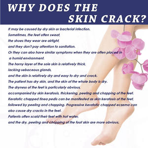 ODM Cuidado hidratante de los pies para los pies agrietados Eliminación de hongos en las uñas de los pies Tratamiento para la picazón - Product Image 4