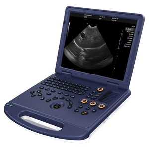 Système d'échographie Doppler couleur vétérinaire <span class=keywords><strong>portable</strong></span> GF-L30i à écran 15 pouces avec batterie intégrée – Prix abordable - Product Image 1