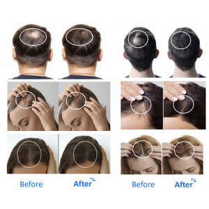 Sérum Ampoule de Récupération Visage et Cou Velash SHGF11, Peptides de Collagène, Complexe de Croissance Capillaire 11, Réparation Professionnelle des Cheveux - Product Image 5