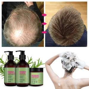 <span class=keywords><strong>Shampooing</strong></span> populaire bio à base de plantes au romarin pour la croissance des <span class=keywords><strong>cheveux</strong></span> <span class=keywords><strong>Shampooing</strong></span> pour <span class=keywords><strong>cheveux</strong></span> secs et abîmés avec logo personnalisé - Product Image 6