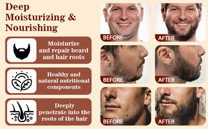 Kit de soin de la barbe en gros, huile à barbe volumisante, favorise la croissance de la barbe, shampoing à barbe, anti-démangeaisons, anti-pelliculaire, produit de soin de la barbe - Product Image 4