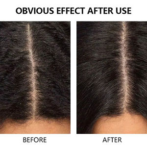 Cgboomprivate Label Formule clarifiante pour éliminer les accumulations, prévenir les pellicules, anti-démangeaisons, brillance et douceur, rinçage capillaire <span class=keywords><strong>au</strong></span> <span class=keywords><strong>vinaigre</strong></span> <span class=keywords><strong>de</strong></span> <span class=keywords><strong>cidre</strong></span> - Product Image 6