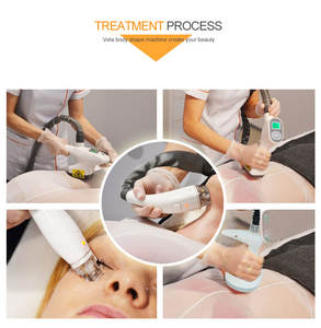 Máquina de Masaje con Rodillos de Vacío, Reafirmante de Piel, Adelgazante de Piernas y Brazos, Reductor de Celulitis, Masajeador Corporal Relajante - Product Image 6