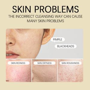 Hot Sales 150ml Natural Organic Facial Skin Care Cleanser Camellia Flower Amino Acid Cleansing Mousse - Product Image 3