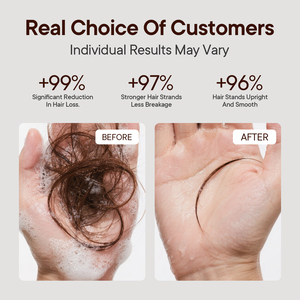 Champú Orgánico, Natural, Sin Crueldad, con Extractos Herbales, Nutritivo, Anticaída, Fortalecedor para Cabello Fino, Reduce la Caída del Cabello - Product Image 2