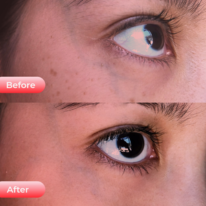 Dispositivo de Cuidado Ocular Kaiyan, Máscara de Terapia de Luz Roja para Ojeras, Hinchazón, Ojos Cansados, Eliminador de Arrugas, Enchufe Estadounidense - Product Image 5