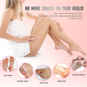 Crema per la riparazione del tallone con crepaccio OEM/ODM Soins De Pieds crema idratante per il piede balsamo Anti Crack per la cura dei tacchi screpolati a secco - Product Image 6